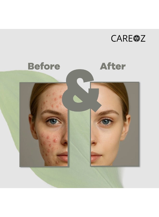 CAREOZ Dead Sea Mud Clay + French Green Clay Detox & Glow All-Over Mask Duo - Image 5